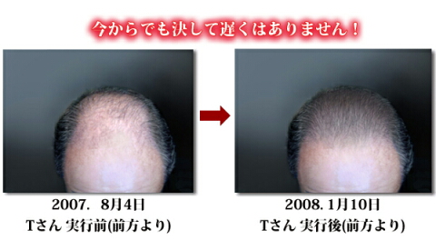 この育毛・発毛マニュアルは、とても多くの方が効果を実感しています